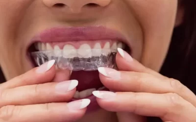 Invisalign Tempe: Clear Aligner Therapy for Discreet Orthodontic Correction